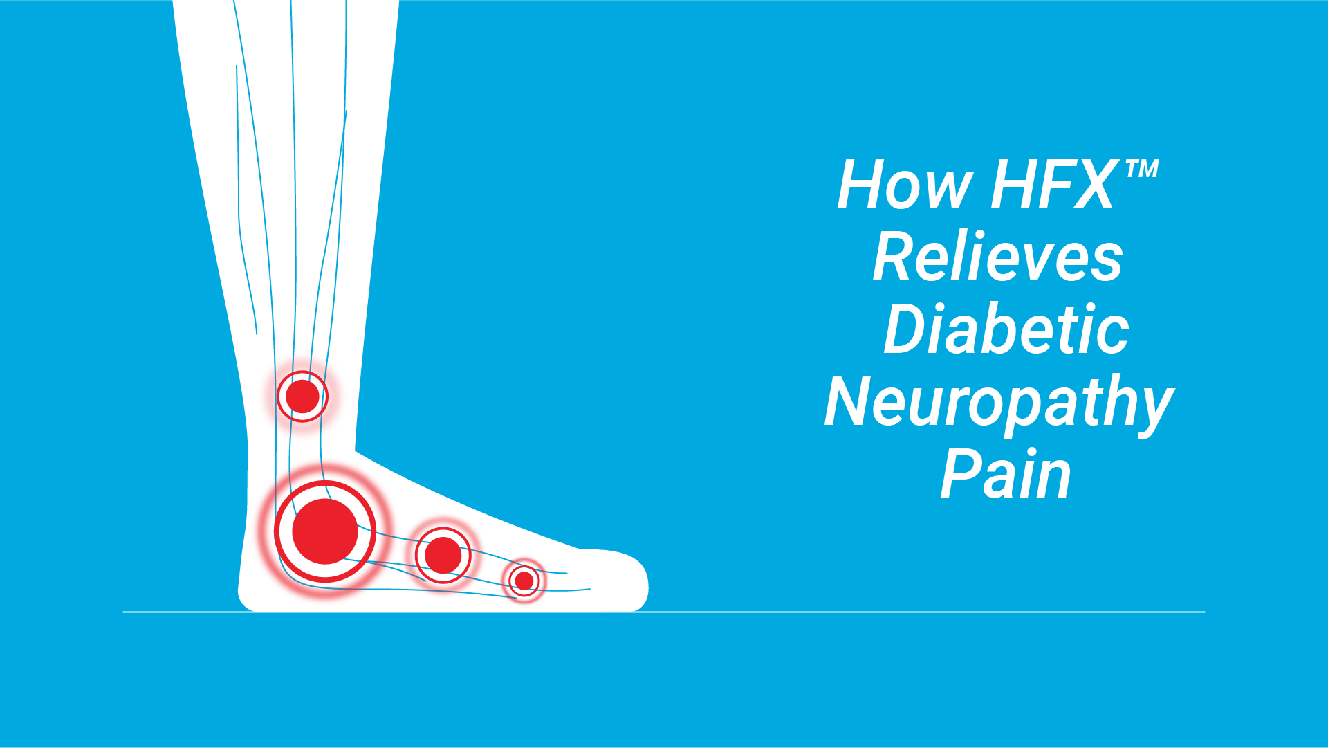 https://www.hfxforpdn.com/app/uploads/2025/07/Video-Thumbnail-HowHFXRelievesDiabeticNeuropathyPain-1.png